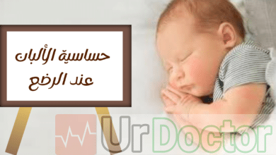 حساسية الألبان عند الرضع